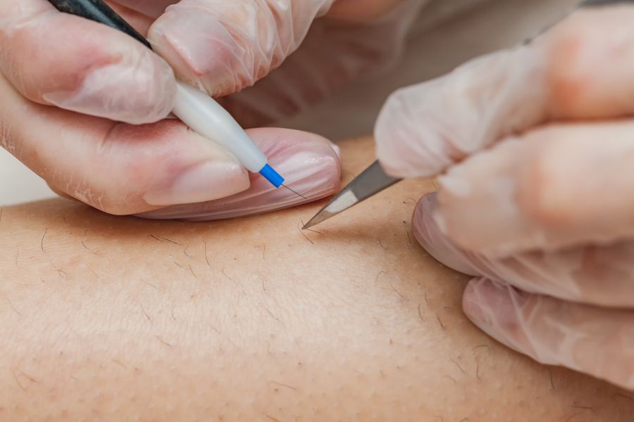 Formation Thermolyse / Électrolyse